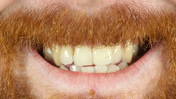 Leende läppar, närbild av rött hår skägg Man — Stockfoto