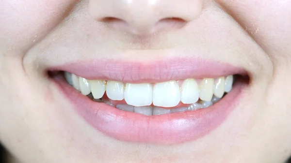 Smiling Girl, close up of Lips — Stock Photo, Image