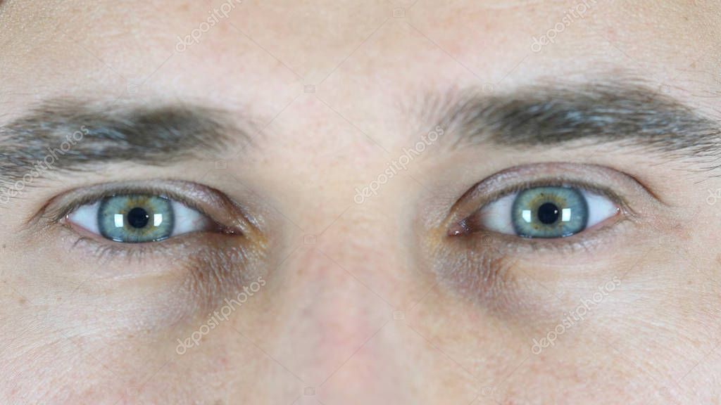 частое моргание глазами. почему человек часто моргает. синдром сухого глаза причины. начинает моргать. зажмуренные глаза.