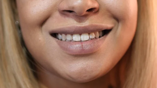 Close Up van glimlachende lippen, Afro-Amerikaans meisje — Stockfoto