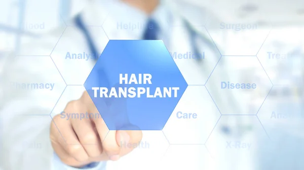 Hårtransplantation, läkare som arbetar på holografiska gränssnitt, rörlig grafik — Stockfoto