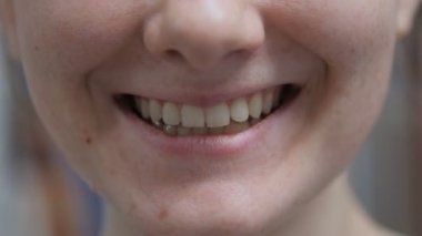 Genç kadın Lipas ve diş gülümsüyor yakın çekim