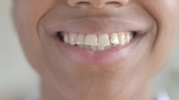 Gros plan sur les dents saines d'une jeune Africaine — Photo