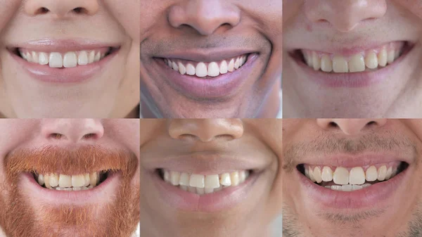 Collage av leende unga människor, läppar och tänder närbild — Stockfoto