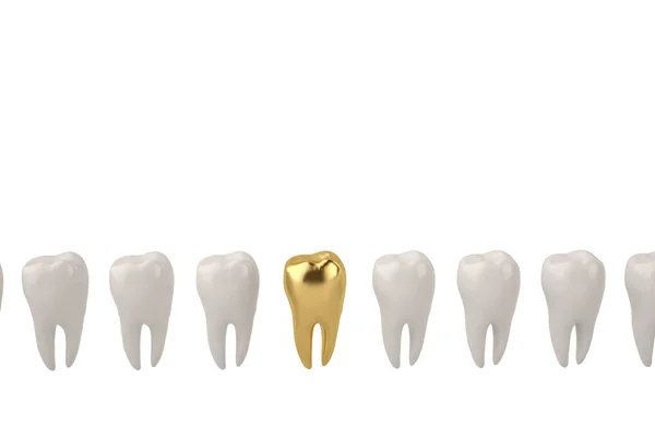 Złoty ząb i czystych zębów na białym tle 3d ilustracja. — Zdjęcie stockowe