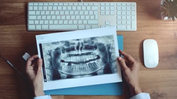 Mujer dentista con radiografía de mandíbula — Vídeos de Stock