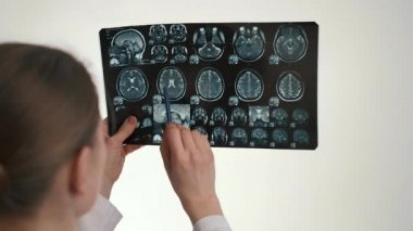 Doktor MRI tarama ile