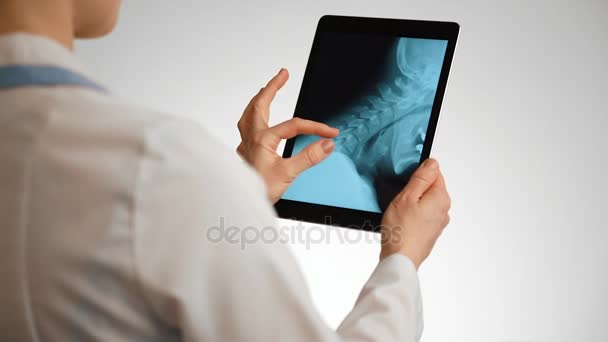 Médecin avec radiographie du cou — Video