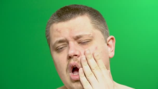 Ospalý mladý muž. On našel pupínek na tváři. Pozadí - zelené. — Stock video