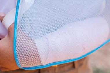 kırık kolu ile oyuncular için çocuk.