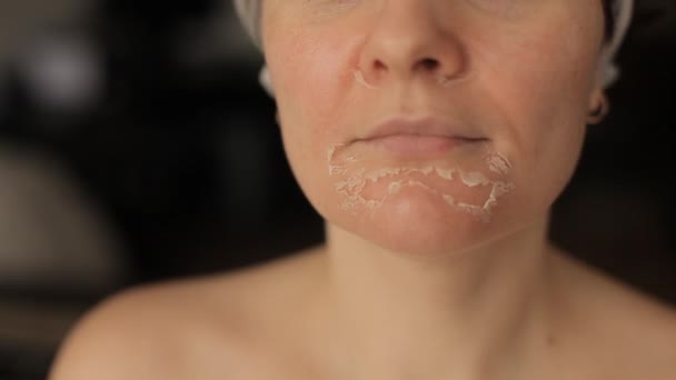 Женщины сталкиваются после химического пилинга. Гладкая кожа на лице — стоковое видео