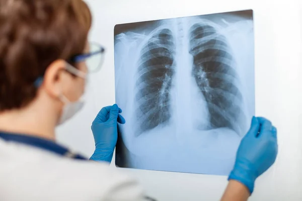 Kadın bir doktor, kovid 19 koronavirüs ve pnömoni ışınlarıyla enfekte olmuş bir hastanın akciğerinin röntgenini inceler. Florografi