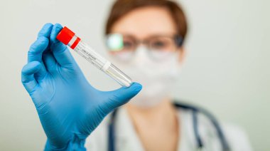 Coronavirus Covid-19 testi. Kadın doktor ya da hemşire hastane laboratuarında burun çubuğu analizi yapıyor..