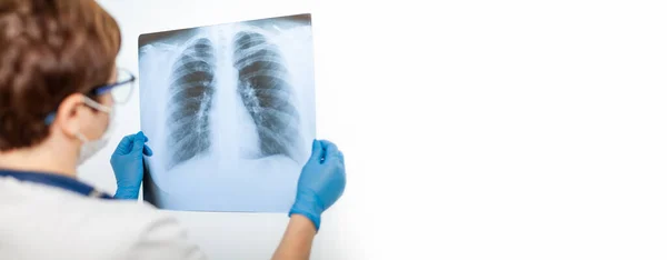 Kadın bir doktor, kovid 19 koronavirüs ve pnömoni ışınlarıyla enfekte olmuş bir hastanın akciğerinin röntgenini inceler. Florografi
