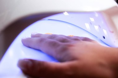 Jel metoduyla plastik çivileri yapıştırmak için UV lambası