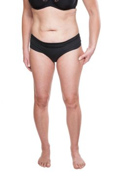 Tombul kadın uyluk pinching