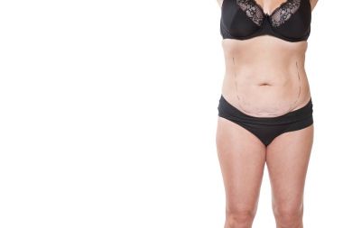 Tombul kadın bedeni marker ile kaplı