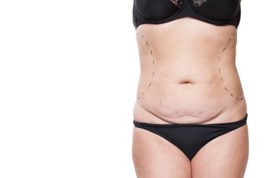 Tombul kadın bedeni marker ile kaplı