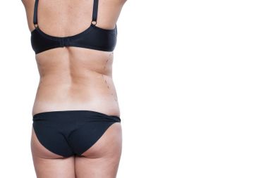 Tombul kadın bedeni marker ile kaplı