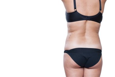 Tombul kadın bedeni marker ile kaplı