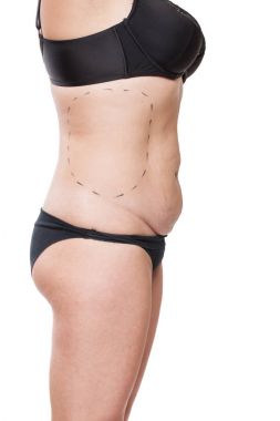 Tombul kadın bedeni marker ile kaplı