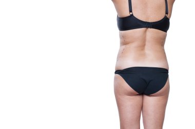 Tombul kadın bedeni marker ile kaplı