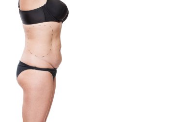 Tombul kadın bedeni marker ile kaplı