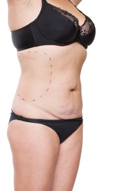 Tombul kadın bedeni marker ile kaplı