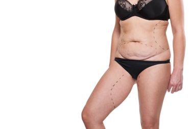 Tombul kadın bedeni marker ile kaplı