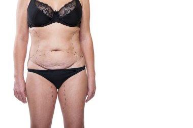 Tombul kadın bedeni marker ile kaplı