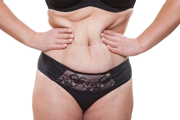 Kadın iç çamaşırı göbek sıkma