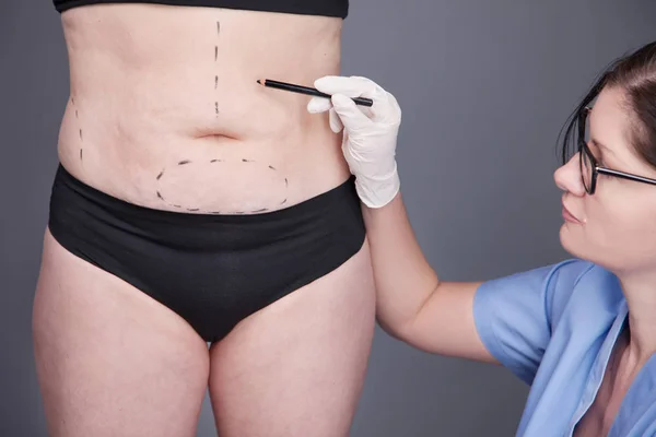 surgeon making marks on patient body