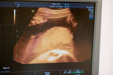 Gebelik sonogram x-ray ultrason inceden inceye gözden geçirmek bir monitörde