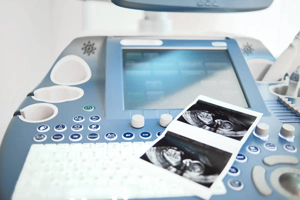 Máquina de escaneo por ultrasonido en la clínica —  Fotos de Stock