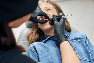 Dişleri ve güzelliği hizalamak için metal diş telleri kullanılıyor.