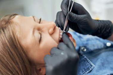 Genç hastaya diş teli takıyorum..