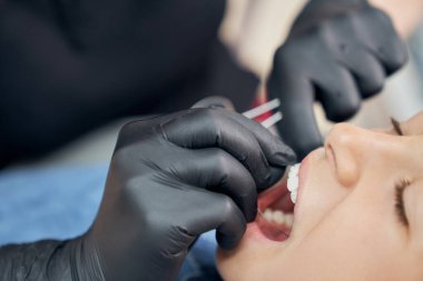 Hasta için diş teli kullanan bir dişçi.