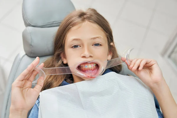 Mały pacjent kliniki stomatologicznej trzymający zwijacz jamy ustnej. — Zdjęcie stockowe