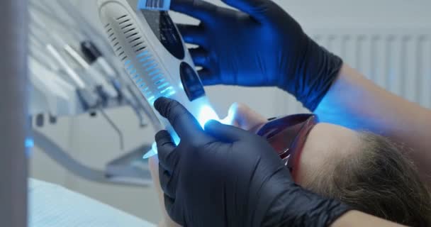 Procedura di sbiancamento dei denti con luce ultravioletta . — Video Stock