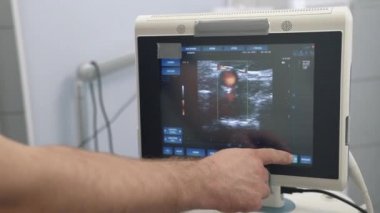 Ultrason muayenesi cihazlar yakın çekim, renk insan organlarını izlemek. Hastane veya klinik tıbbi Araçlar