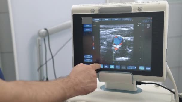 Ultrasound examination devices monitor close-up, color human organs. Medical tools in hospital or clinic — Stock Video