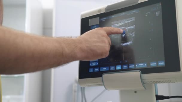 Los dispositivos de examen por ultrasonido monitorean de cerca los órganos humanos de color. Herramientas médicas en el hospital o clínica — Vídeos de Stock