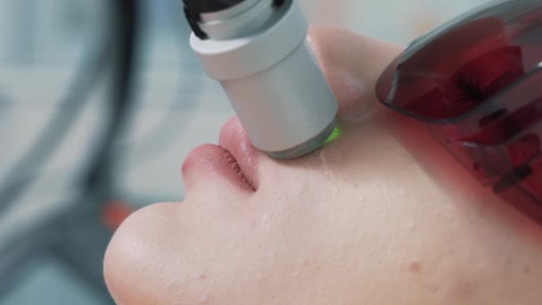 Fechar a área dos lábios no rosto da mulher durante o procedimento de depilação a laser — Vídeo de Stock