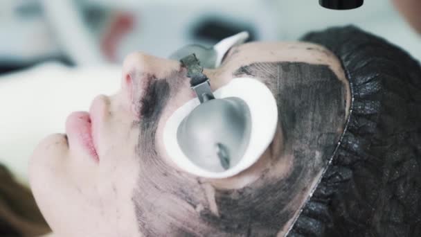 Жінка в захисних окулярах на процедурі пілінгу вуглецевого обличчя, повільний рух — стокове відео
