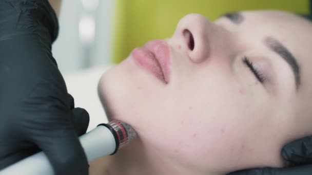 Крупный план косметолога делает процедуру для лечения без инъекций — стоковое видео