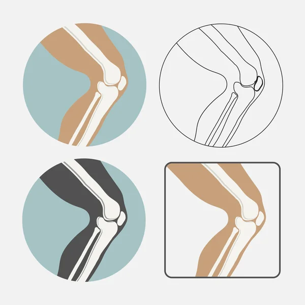 Conjunto de ícones da articulação do joelho humano, logotipo para clínica ortopédica, estílico plano — Vetor de Stock