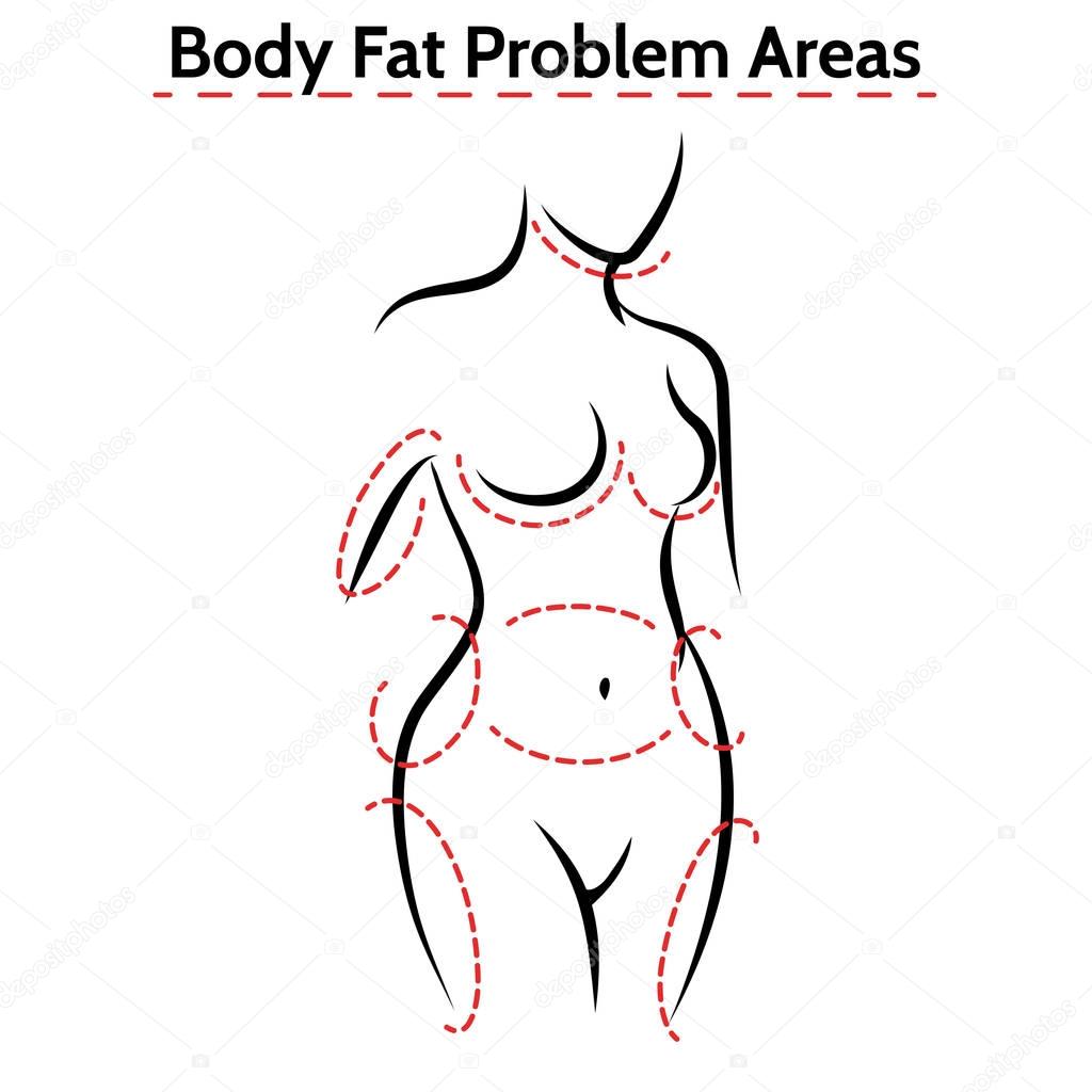 Female body fat problems areas poster