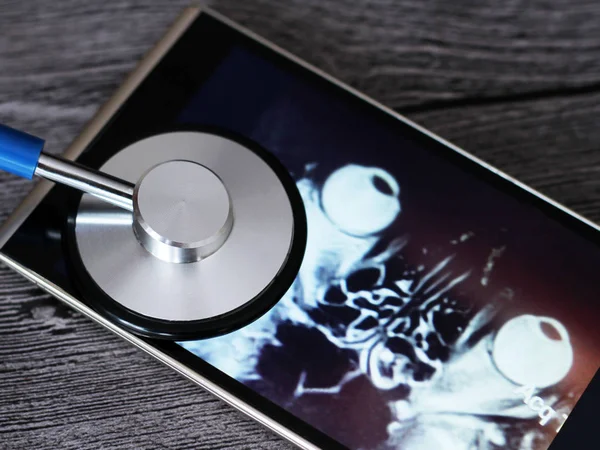 X-Ray en stethoscoop, medisch onderzoek — Stockfoto