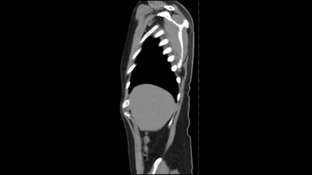 腹部側ビュー滑らかな動きの スキャン — ストック動画