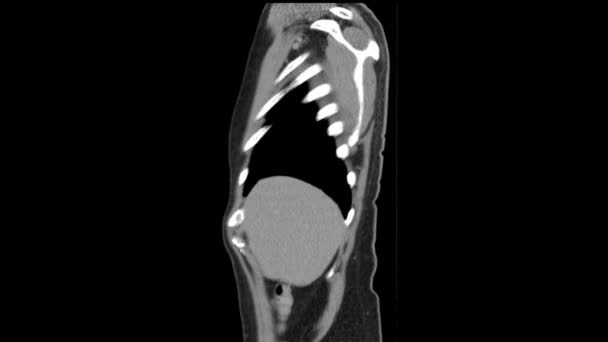 ct scan de l'abdomen vue latérale mouvement lisse 